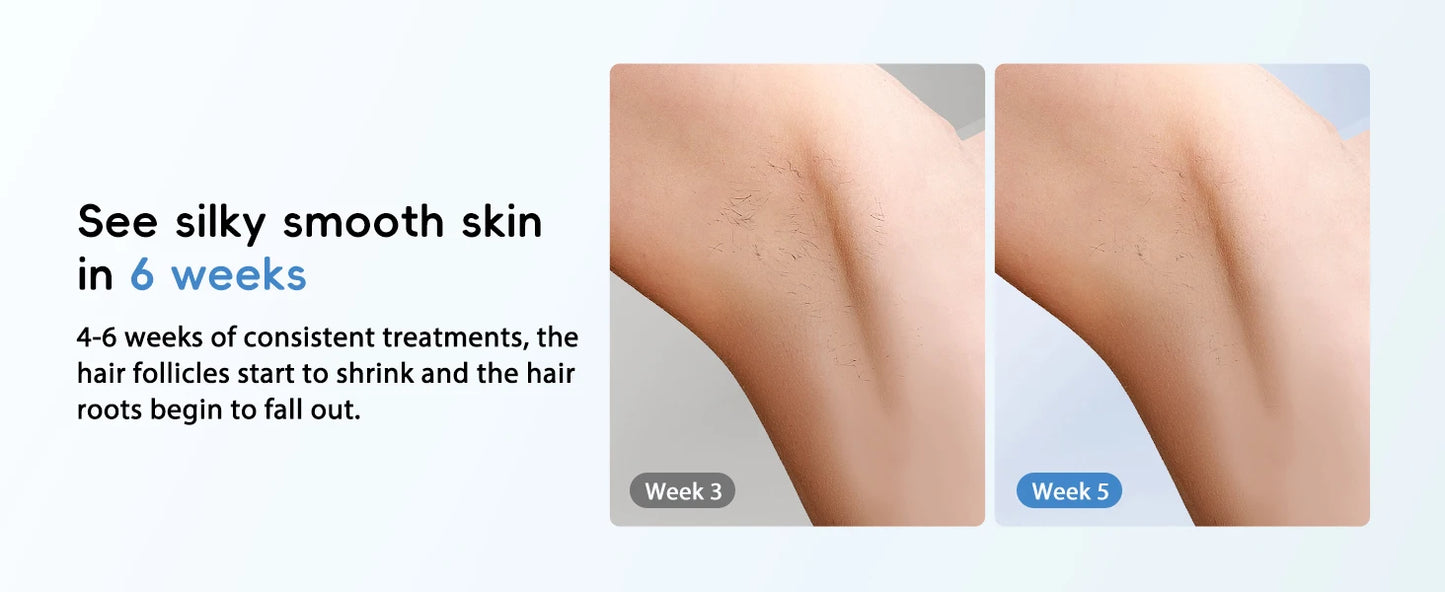 IPL Hair Removal Laser 22J Unlimted IGBT 5.2 cm² light Quick Flashes Painless Epilator Face Armpit Bikini Treament for men women